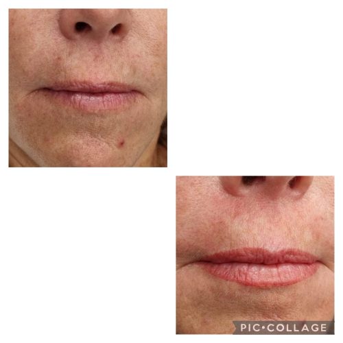 labios-microblading-angeles-noguera