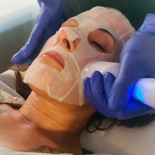 hydrafacial-angeles-noguera